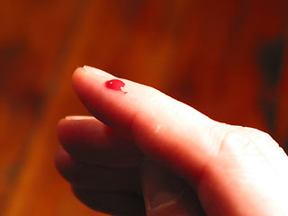 bloody_finger_320.jpg